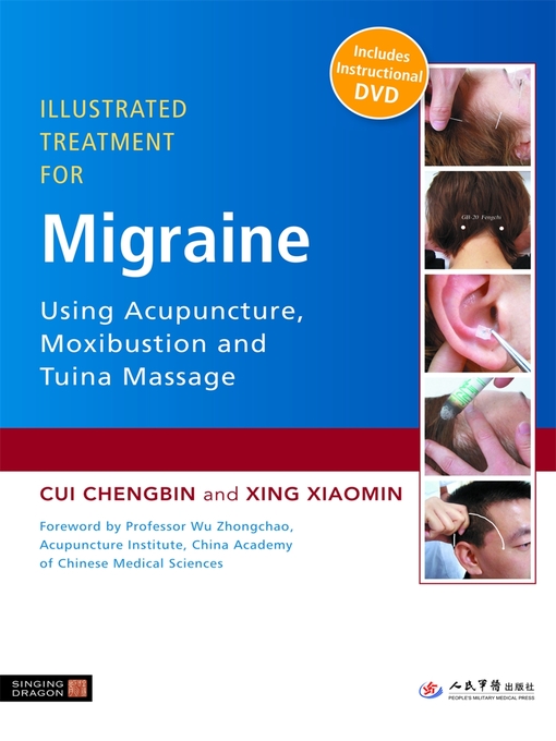 Title details for Illustrated Treatment for Migraine Using Acupuncture, Moxibustion and Tuina Massage by Cui Chengbin - Available